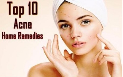 10 Natural Home Remedies for Acne Pimple Treatment