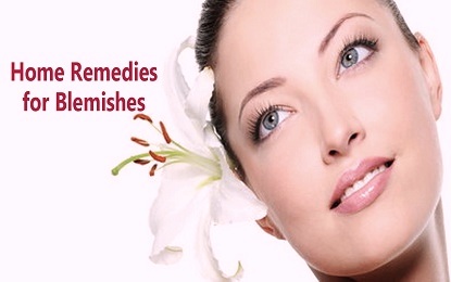 10 Natural and Effective Home Remedies for Blemishes Cure