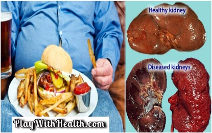 Top 6 Bad Habits That Can Cause Kidney Damage