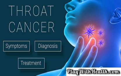 12 Symptoms And Signs Of Throat Cancer - NATURAL HEALTH