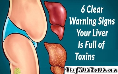 Did You Know These 6 Warning Signals That Show Your Liver Is Full of Toxins