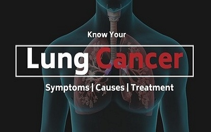 Lungs Cancer Symptoms Causes Treatment