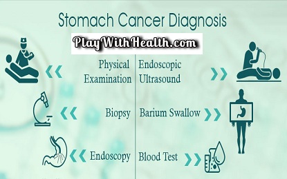 Stomach Cancer Diagnosis Tips